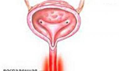 Upozoravajući simptomi i pravovremeno liječenje uretritisa kod muškaraca: lijek i invazivni uretritis i njegovo liječenje kod kuće