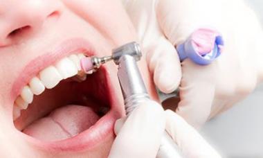 Professionaalne suuhügieen Suuhügieen hambaravis, mis sisaldab
